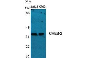 Western Blotting (WB) image for anti-Activating Transcription Factor 4 (Tax-Responsive Enhancer Element B67) (ATF4) (Ser159) antibody (ABIN3174554) (ATF4 抗体  (Ser159))