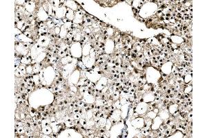 IHC analysis of C-Jun/JUN using anti-C-Jun/JUN antibody (ABIN7601421). (C-JUN 抗体  (AA 35-331))