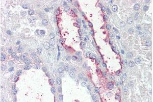 Immunohistochemistry (IHC) image for anti-Potassium Voltage-Gated Channel, Isk-Related Family, Member 3 (Kcne3) (Internal Region) antibody (ABIN570822)