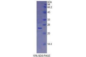 SDS-PAGE analysis of Dog MHCDRa Protein. (HLA-DRA 蛋白)