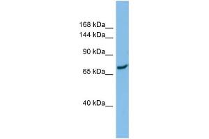 Host:  Rabbit  Target Name:  SLC8A1  Sample Type:  ACHN Whole Cell lysates  Antibody Dilution:  1. (SLC8A1 抗体  (N-Term))