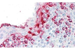 Detection of KLK8 in Human Tonsil Tissue using Polyclonal Antibody to Kallikrein 8 (KLK8) (Kallikrein 8 抗体  (AA 29-260))