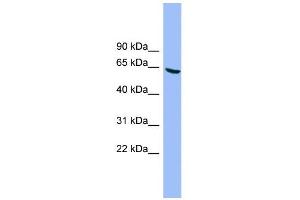 WB Suggested Anti-DYRK3 Antibody Titration: 0. (DYRK3 抗体  (N-Term))