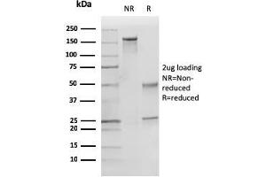 SDS-PAGE Analysis Purified p27 Mouse Monoclonal Antibody (KIP1/769). (CDKN1B 抗体)