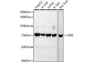 Western blot analysis of extracts of various cell lines, using GNE antibody (ABIN7267398) at 1:1000 dilution. (GNE 抗体)