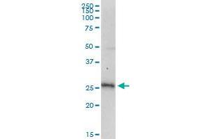 Western Blotting (WB) image for anti-Single-Strand-Selective Monofunctional Uracil-DNA Glycosylase 1 (SMUG1) (AA 1-177) antibody (ABIN949130)