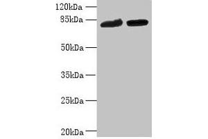 Western blot All lanes: DDHD2 antibody at 10 μg/mL Lane 1: K562 whole cell lysate Lane 2: U251 whole cell lysate Secondary Goat polyclonal to rabbit IgG at 1/10000 dilution Predicted band size: 82, 38 kDa Observed band size: 82 kDa (DDHD2 抗体  (AA 361-650))