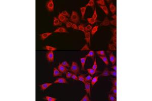 Immunofluorescence (IF) image for anti-RanBP-Type and C3HC4-Type Zinc Finger Containing 1 (RBCK1) antibody (ABIN7269848)