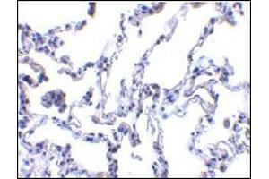 AP30640PU-N p53R2 antibody staining of Human lung tissue by Immunohistochemistry at 1 μg/ml. (RRM2B 抗体  (N-Term))