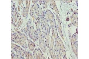 Immunohistochemistry of paraffin-embedded human pancreatic tissue using ABIN7160787 at dilution of 1:100 (SCYL1 抗体  (AA 460-740))