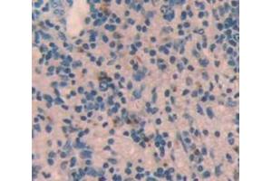 Used in DAB staining on fromalin fixed paraffin- embedded Kidney tissue (STING/TMEM173 抗体  (AA 160-371))