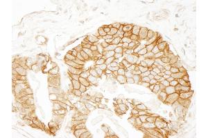 Immunohistochemistry (IHC) image for anti-Catenin, beta (CATNB) (AA 760-781) antibody (ABIN7448432) (beta Catenin 抗体  (AA 760-781))
