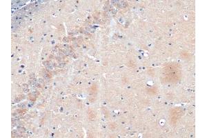 Immunohistochemistry (IHC) image for anti-Enolase 2 (Gamma, Neuronal) (ENO2) (AA 2-434) antibody (ABIN7431956)