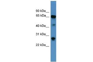 WB Suggested Anti-CANX Antibody Titration: 1. (Calnexin 抗体  (Middle Region))