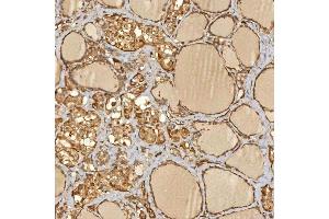 IHC analysis of SNX4 using anti-SNX4 antibody (ABIN7599406).