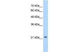 WB Suggested Anti-DLX2 Antibody Titration:  2.