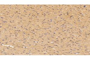 Detection of MYO in Rat Cardiac Muscle Tissue using Polyclonal Antibody to Myoglobin (MYO) (Myoglobin 抗体  (AA 1-154))