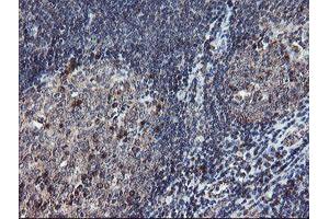 Image no. 14 for anti-Diphthamide Biosynthesis Protein 2 (DPH2) antibody (ABIN1497893)