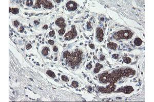 Immunohistochemical staining of paraffin-embedded Human breast tissue using anti-DPH2 mouse monoclonal antibody. (DPH2 抗体)