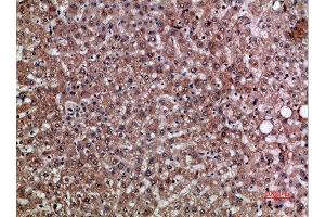 Immunohistochemical analysis of paraffin-embedded human-liver, antibody was diluted at 1:200 (CXCL12 抗体  (AA 31-80))