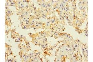 Immunohistochemistry of paraffin-embedded human lung tissue using ABIN7148571 at dilution of 1:100 (CIR1 抗体  (AA 1-160))
