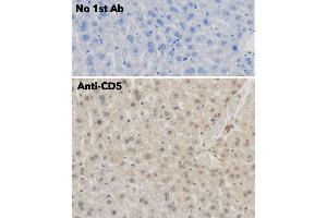 Immunohistochemistry (IHC) image for anti-CD5 (CD5) (AA 105-210) antibody (ABIN7272988)