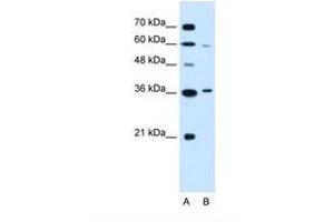 Image no. 2 for anti-Presenilin Associated, Rhomboid-Like (PARL) (AA 97-146) antibody (ABIN6738135) (PARL 抗体  (AA 97-146))