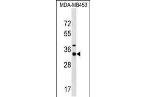 Western blot analysis in MDA-MB453 cell line lysates (35ug/lane). (MYOZ2 抗体  (N-Term))