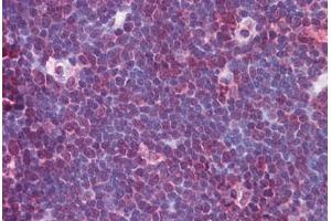 Human Thymus: Formalin-Fixed, Paraffin-Embedded (FFPE) (NLRP13 抗体  (N-Term))