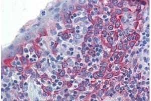 Human Tonsil (formalin-fixed, paraffin-embedded) stained with LIN7C antibody ABIN462236 followed by biotinylated goat anti-rabbit IgG secondary antibody ABIN481713, alkaline phosphatase-streptavidin and chromogen. (LIN7C 抗体  (N-Term))