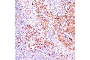 Immunohistochemistry of paraffin-embedded mouse spleen using MZB1 antibody (ABIN7268403) at dilution of 1:100 (40x lens). (MZB1 抗体  (AA 1-189))