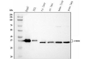 Western blot analysis of CYB5R3 using anti-CYB5R3 antibody (ABIN7600822).