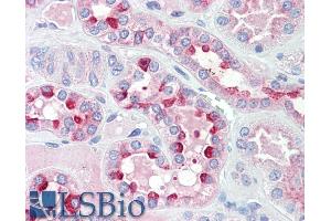 ABIN768559 (5µg/ml) staining of paraffin embedded Human Kidney. (IDH3G 抗体  (AA 337-350))