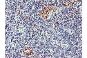 Immunohistochemistry (IHC) image for anti-ArfGAP with GTPase Domain, Ankyrin Repeat and PH Domain 1 (AGAP1) antibody (ABIN1497475)