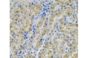 Immunohistochemistry of paraffin-embedded Mouse kidney using SERPINA6 Polyclonal Antibody at dilution of 1:100 (40x lens). (SERPINA6 抗体)