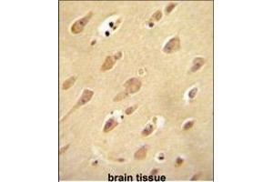 Immunohistochemistry (Paraffin-embedded Sections) (IHC (p)) image for anti-Olfactory Receptor, Family 5, Subfamily L, Member 2 (OR5L2) (AA 62-90), (N-Term) antibody (ABIN655018)