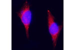 IF analysis of ZAC/Plagl1 using anti-ZAC/Plagl1 antibody (ABIN7599464).