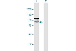 Western Blot analysis of ZFYVE9 expression in transfected 293T cell line by ZFYVE9 MaxPab polyclonal antibody. (ZFYVE9 抗体  (AA 1-762))