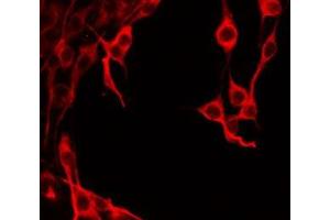 ABIN6277899 staining HeLa by IF/ICC. (Amylin/DAP 抗体  (Internal Region))