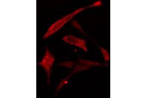 ABIN6274778 staining A549 cells by IF/ICC. (RPL30 抗体  (C-Term))