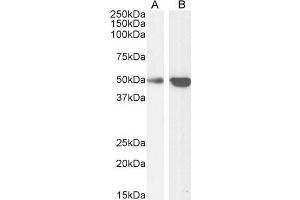 Western Blotting (WB) image for anti-TNF Receptor-Associated Factor 2 (TRAF2) (C-Term) antibody (ABIN190911)