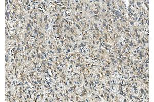 IHC analysis of SYP using anti-SYP antibody (ABIN7603120). (Synaptophysin 抗体  (N-Term))