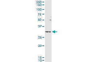 Immunoprecipitation (IP) image for anti-Solute Carrier Family 25 (Mitochondrial Carrier, Adenine Nucleotide Translocator), Member 5 (SLC25A5) (AA 1-298) antibody (ABIN947558)