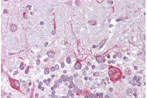 Anti-PSEN1 / Presenilin 1 antibody IHC staining of human brain, cerebellum. (Presenilin 1 抗体  (AA 107-156))