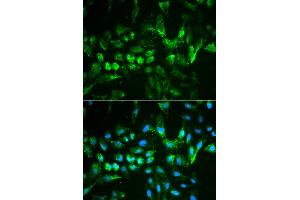 Immunofluorescence analysis of MCF-7 cells using TIMP2 antibody. (TIMP2 抗体)