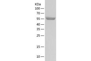 Western Blotting (WB) image for Protein Phosphatase, Mg2+/Mn2+ Dependent, 1G (PPM1G) (AA 1-546) protein (His tag) (ABIN7124674) (PPM1G Protein (AA 1-546) (His tag))