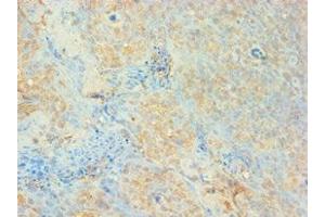 Immunohistochemistry of paraffin-embedded human tonsil tissue using ABIN7159650 at dilution of 1: 100 (AUH 抗体  (AA 68-339))