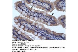 Human Intestine (SMPDL3B 抗体  (N-Term))