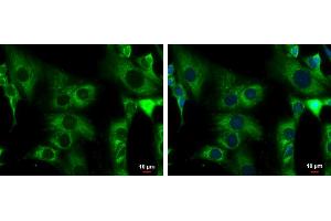 ICC/IF Image ACADM antibody detects ACADM protein at mitochondria by immunofluorescent analysis. (Medium-Chain Specific Acyl-CoA Dehydrogenase, Mitochondrial (C-Term) 抗体)