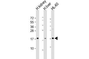 All lanes : Anti-FHIT Antibody (N-Term) at 1:2000 dilution Lane 1: human kidney lysate Lane 2: human liver lysate Lane 3: HL-60 whole cell lysate Lysates/proteins at 20 μg per lane. (FHIT 抗体  (AA 19-54))